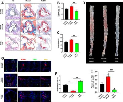 YKL-40 Aggravates Early-Stage Atherosclerosis by Inhibiting Macrophage Apoptosis in an Aven-dependent Way